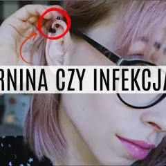 Jak leczyć infekcję po piercingu: skuteczne metody i porady