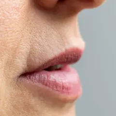 Jak usunąć kwas hialuronowy z ust domowe sposoby, które nie działają