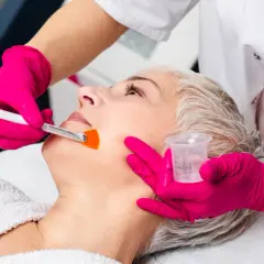 Peeling chemiczny co to? Odkryj korzyści i skutki uboczne zabiegu