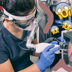 Jak wygląda usunięty tatuaż? Efekty i proces laserowego usuwania