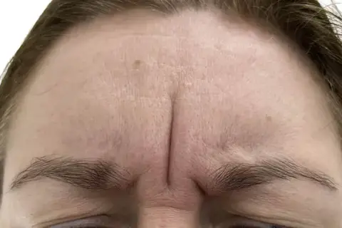 Gdzie kupić botox Allergan? Sprawdzone miejsca i ważne informacje