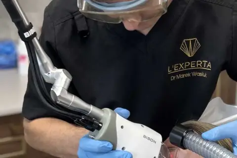Laser frakcyjny jak często? Odkryj idealną częstotliwość zabiegów