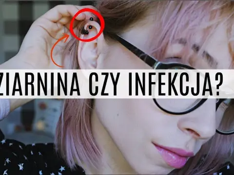 Jak leczyć infekcję po piercingu: skuteczne metody i porady