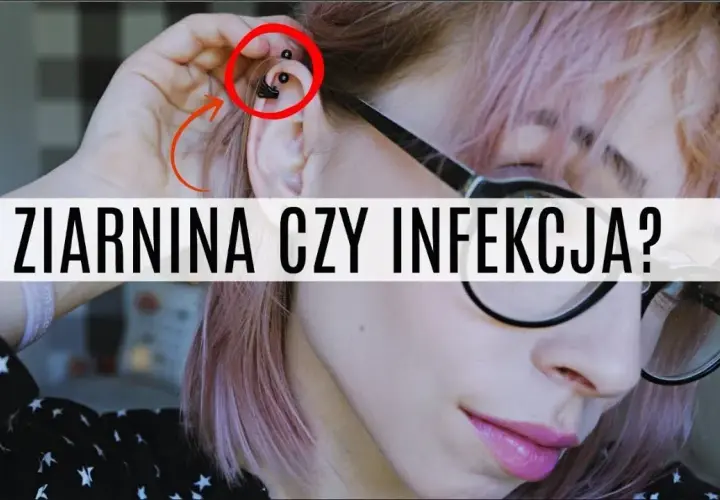 Jak leczyć infekcję po piercingu: skuteczne metody i porady