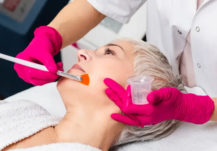 Peeling chemiczny co to? Odkryj korzyści i skutki uboczne zabiegu