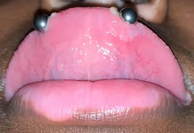 Snake eye piercing co to - wszystko, co musisz wiedzieć przed decyzją