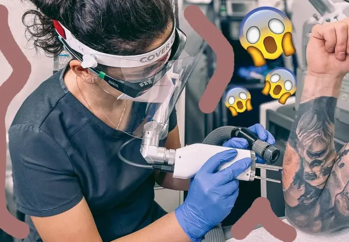 Jak wygląda usunięty tatuaż? Efekty i proces laserowego usuwania