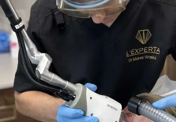 Laser frakcyjny jak często? Odkryj idealną częstotliwość zabiegów