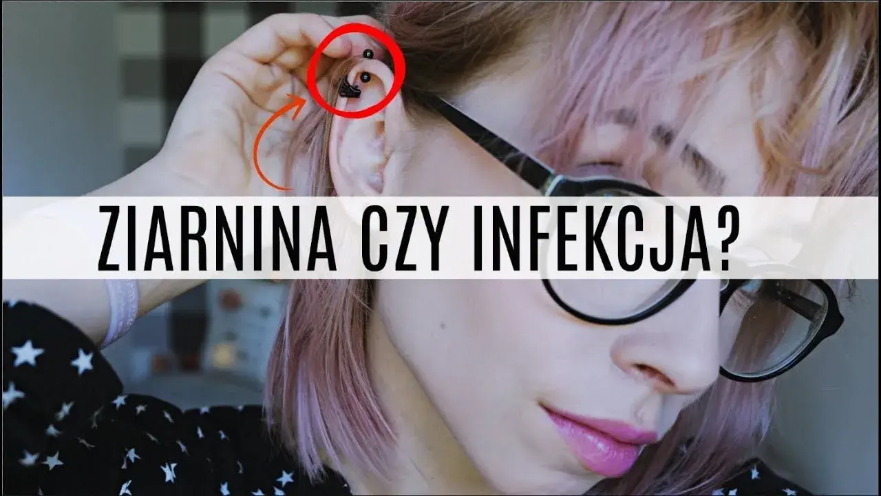 Jak leczyć infekcję po piercingu: skuteczne metody i porady